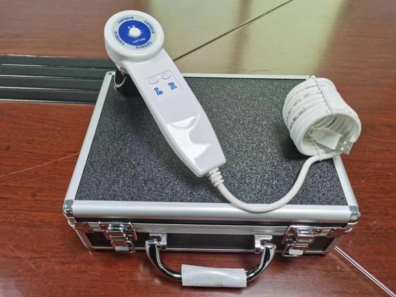 5.0MP Digital Iridology Camera - Qh Furniture 评论和价格